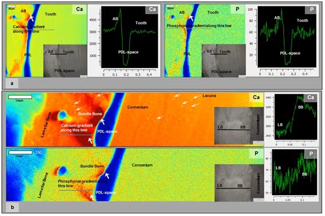  Low resolution µ-XRF area maps of bone-PDL-tooth complex illustrated regions.