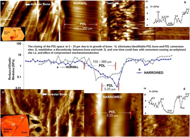 Line profiles on a reduced elastic modulus illustrating significant gradients at bone-PDL and cementum-PDL attachment sites.