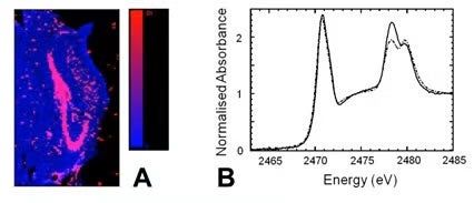 Figure 2.  XRF mapping at Beam Line 10-2 (Figure 2B) revealed the distribution of Zn and K in healthy brain tissue, and brain tissue following ischemic stroke (Silasi et al. 2012).  Sulfur K-edge XAS was performed at Beam Line 4-3 (Figure 2B), and revealed increased levels of taurine within grey matter (black line), relative to white matter (dashed line).  This trend was only observed in non-fixed flash frozen brain tissue (Hackett et al. 2012).
